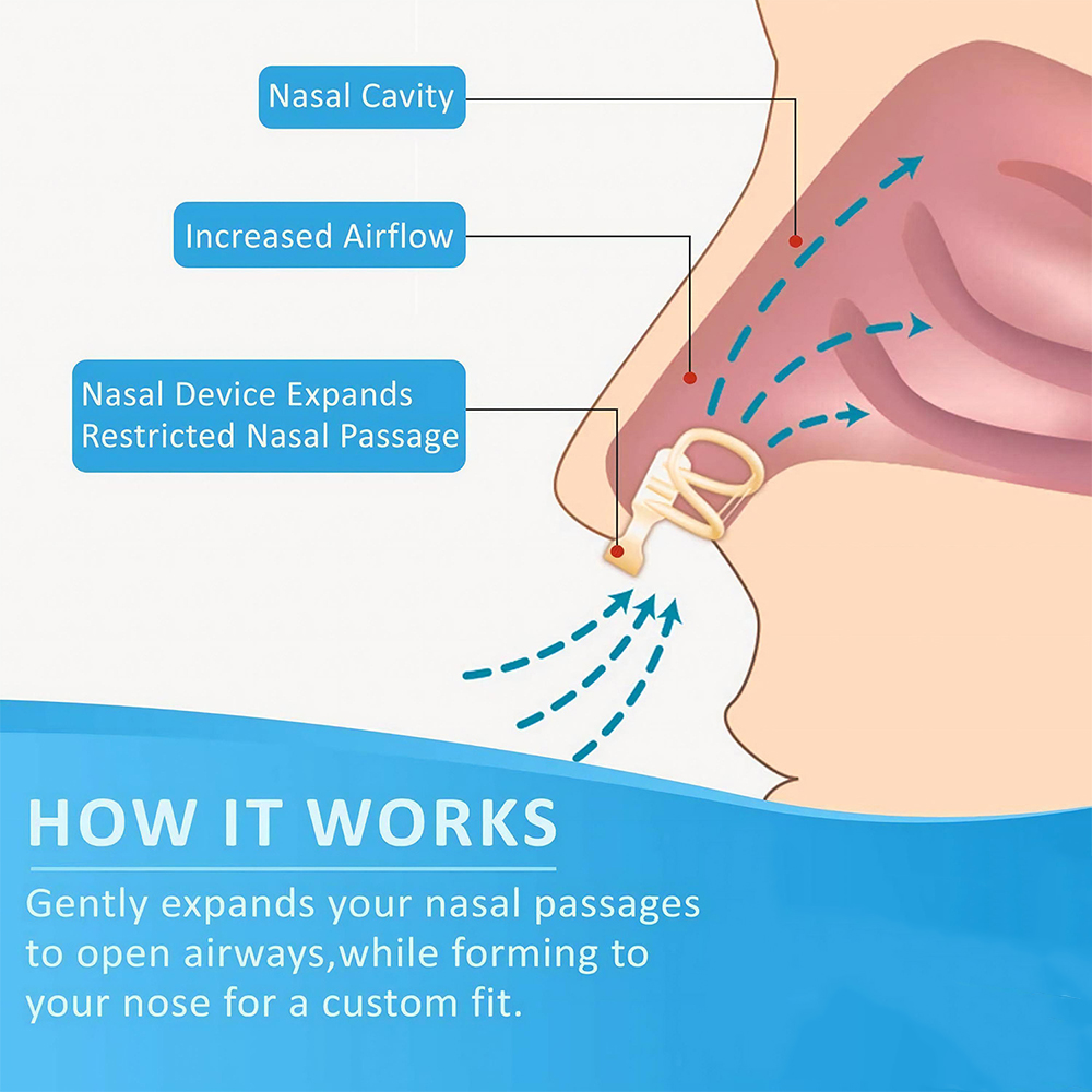 Snore Stopper Dilator จมูกสําห - Anti Snore Contour Pillow บทวิจารณ์และราคา